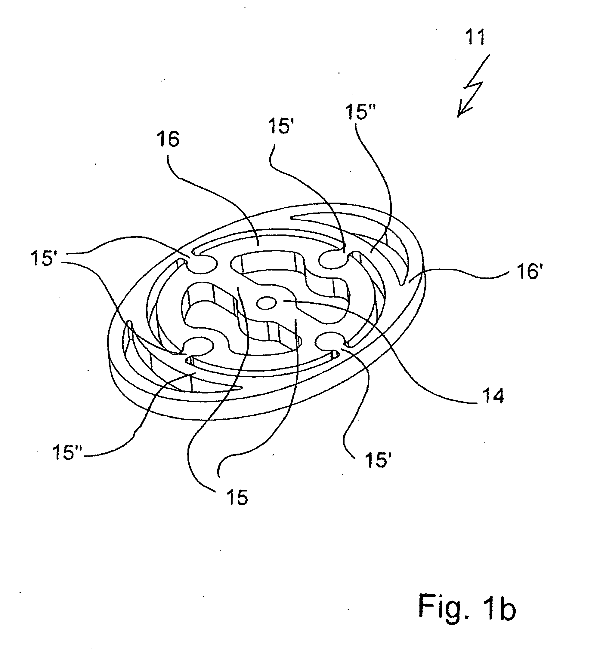 Auditory ossicle prosthesis with variable coupling surfaces