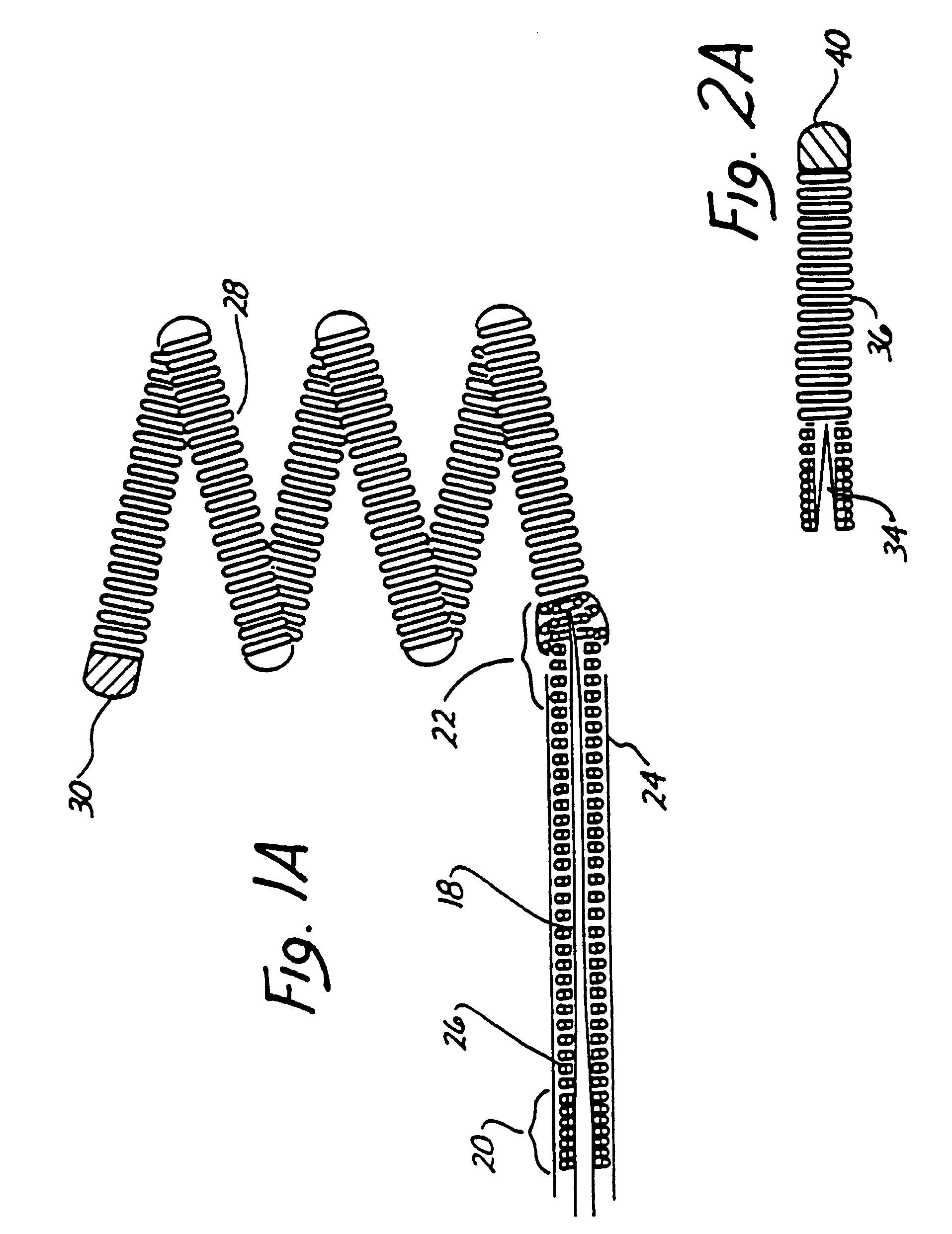 Endovascular electrolytically detachable wire and tip for the formation of thrombus in arteries, veins, aneurysms, vascular malformations and arteriovenous fistulas