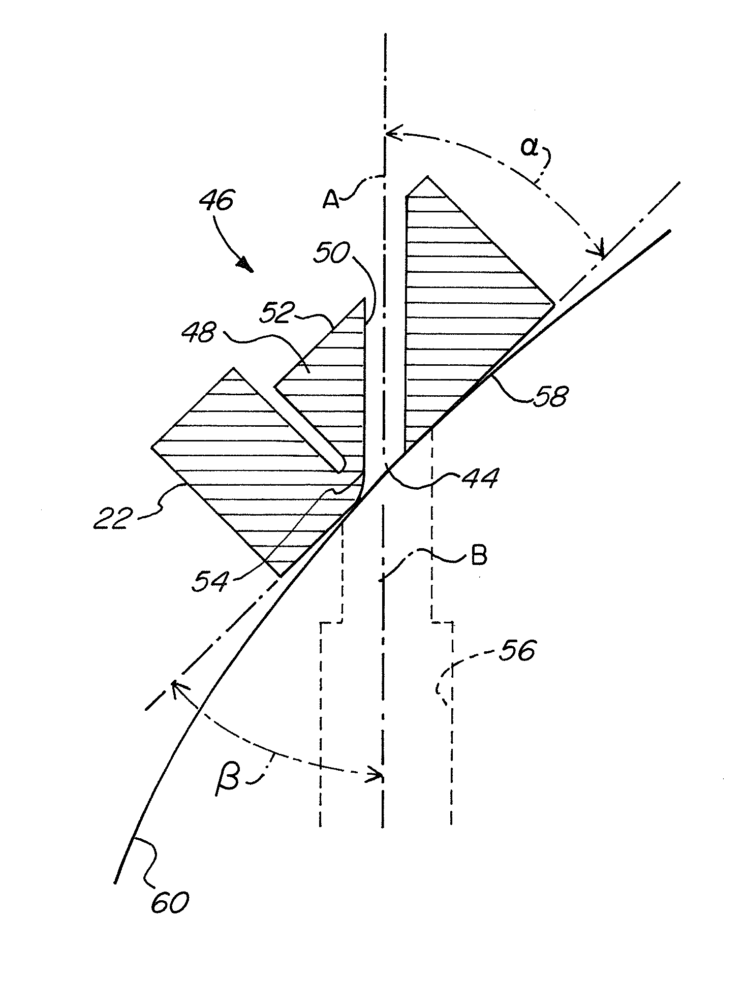 Method and device for the fixation of a tendon graft