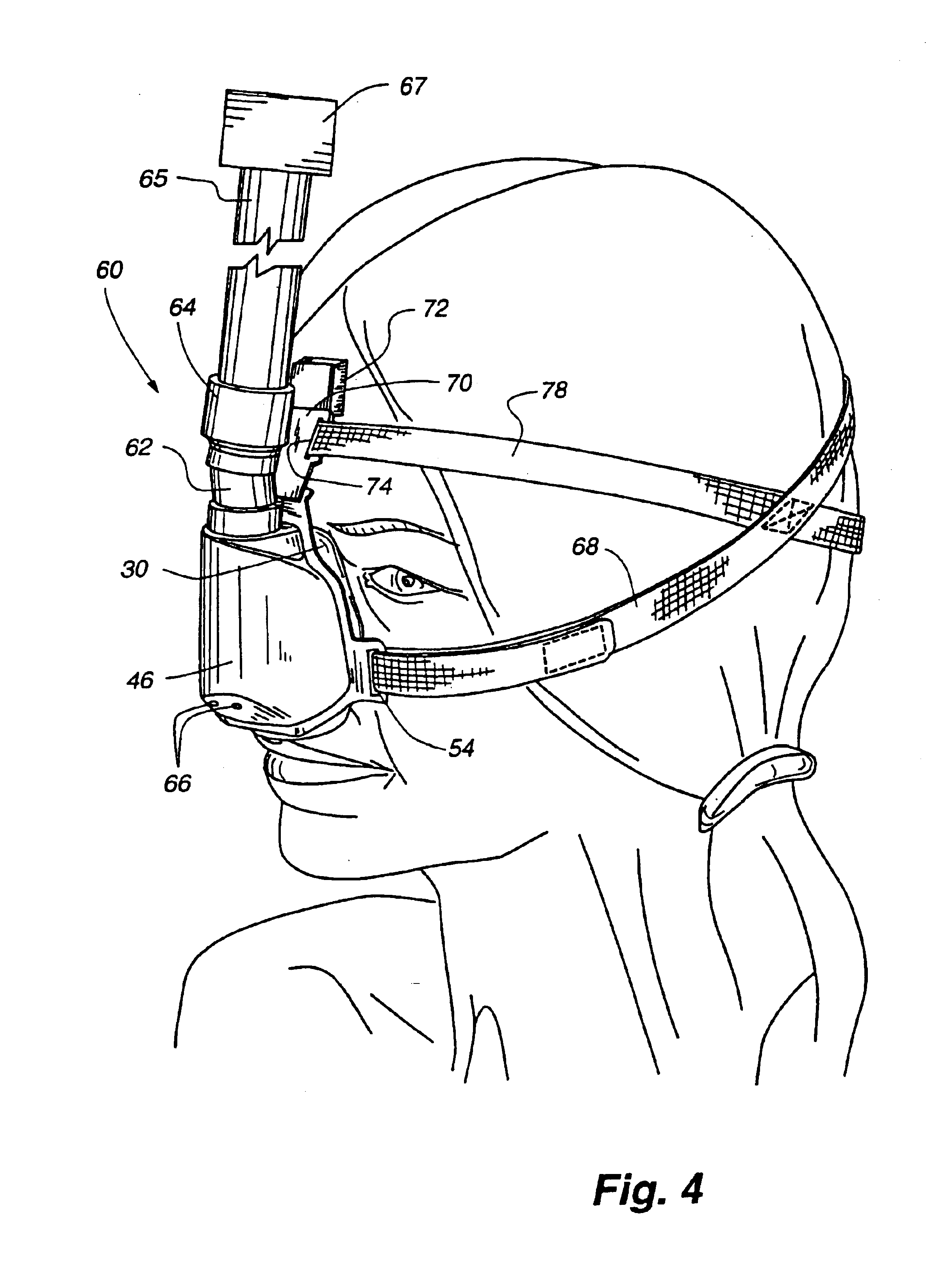 Nasal mask cushion assembly