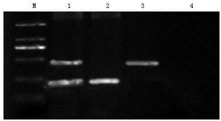 Multiple RT-PCR detection kit for American type porcine reproductive and respiratory syndrome virus and porcine parvovirus