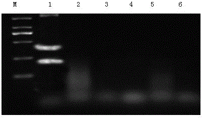 Multiple RT-PCR detection kit for American type porcine reproductive and respiratory syndrome virus and porcine parvovirus