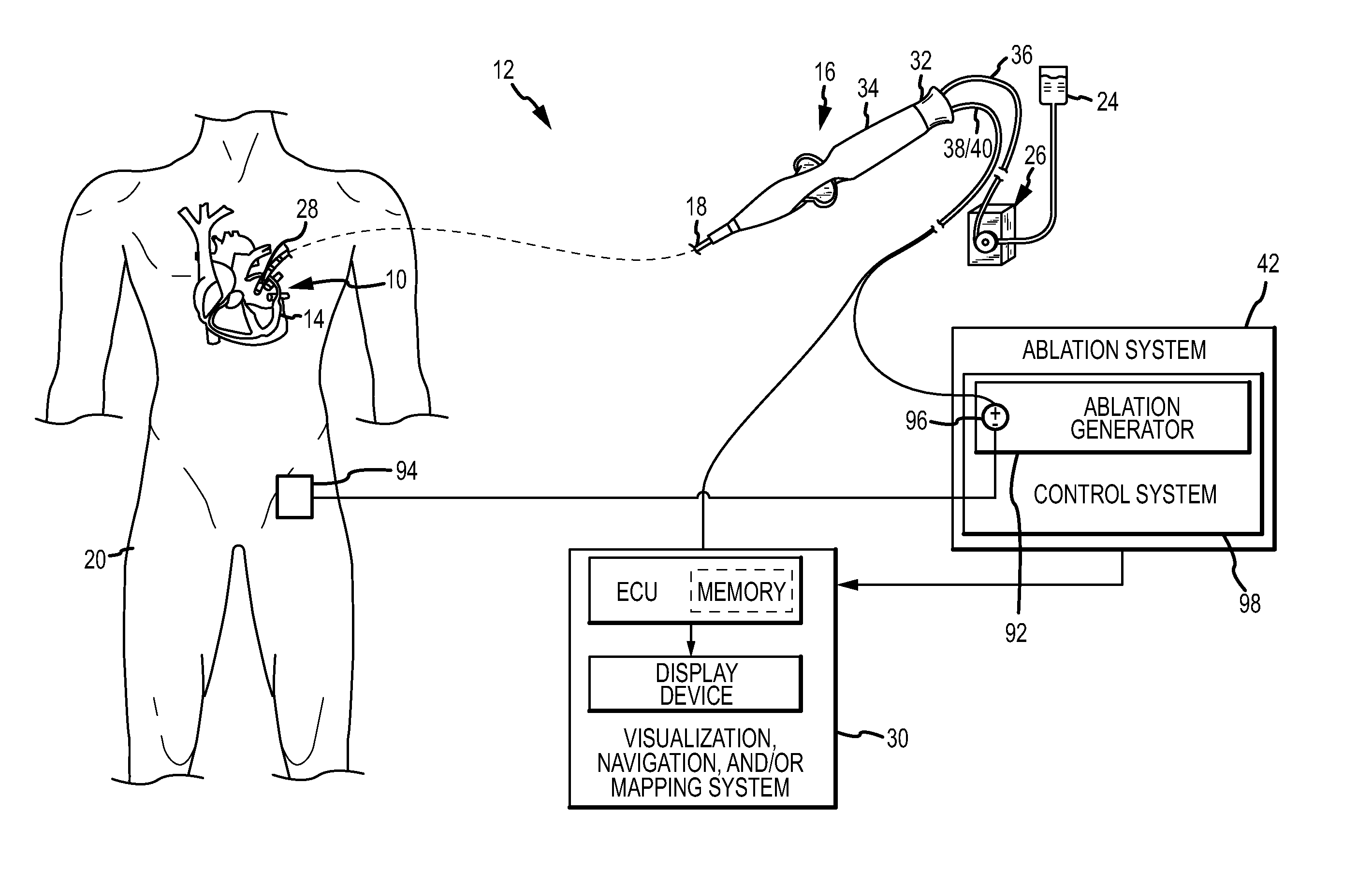 Irrigant distribution system for flexible electrodes