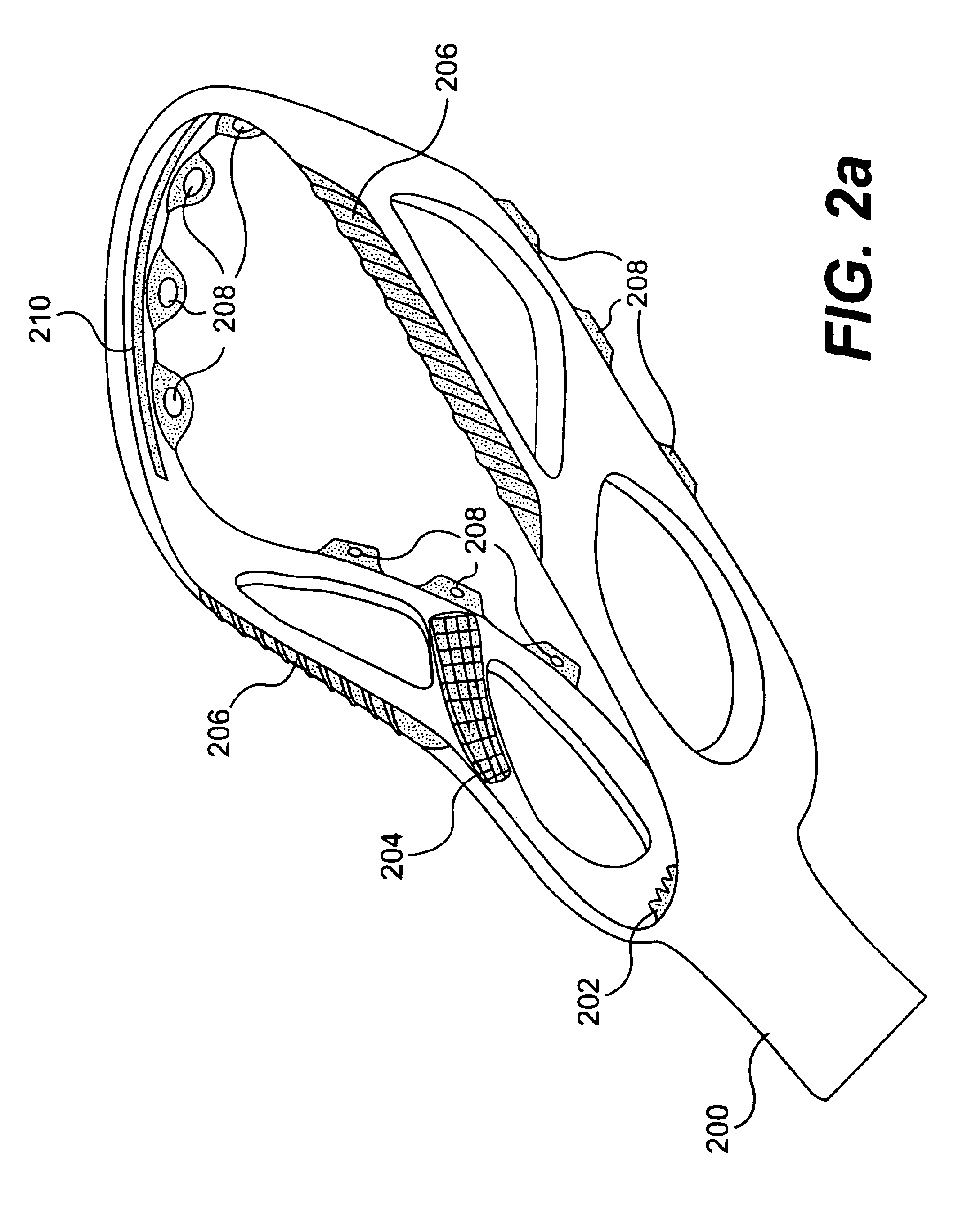 Multi-component lacrosse stick head