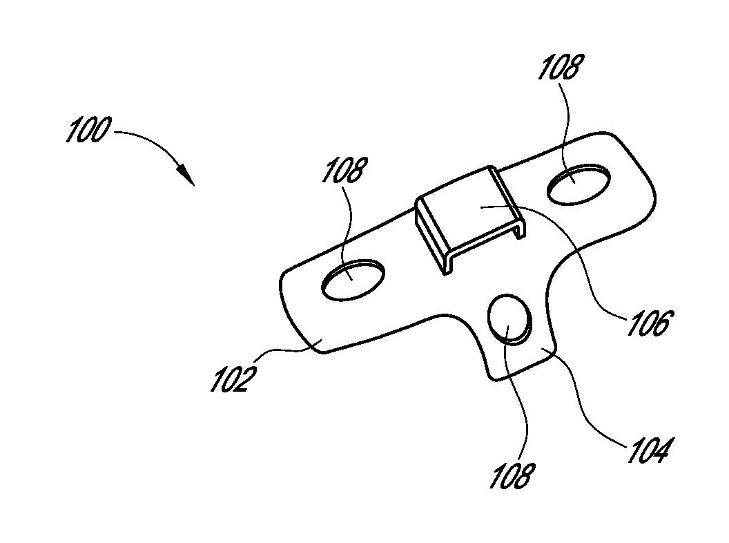 Method and device for correcting bone deformities