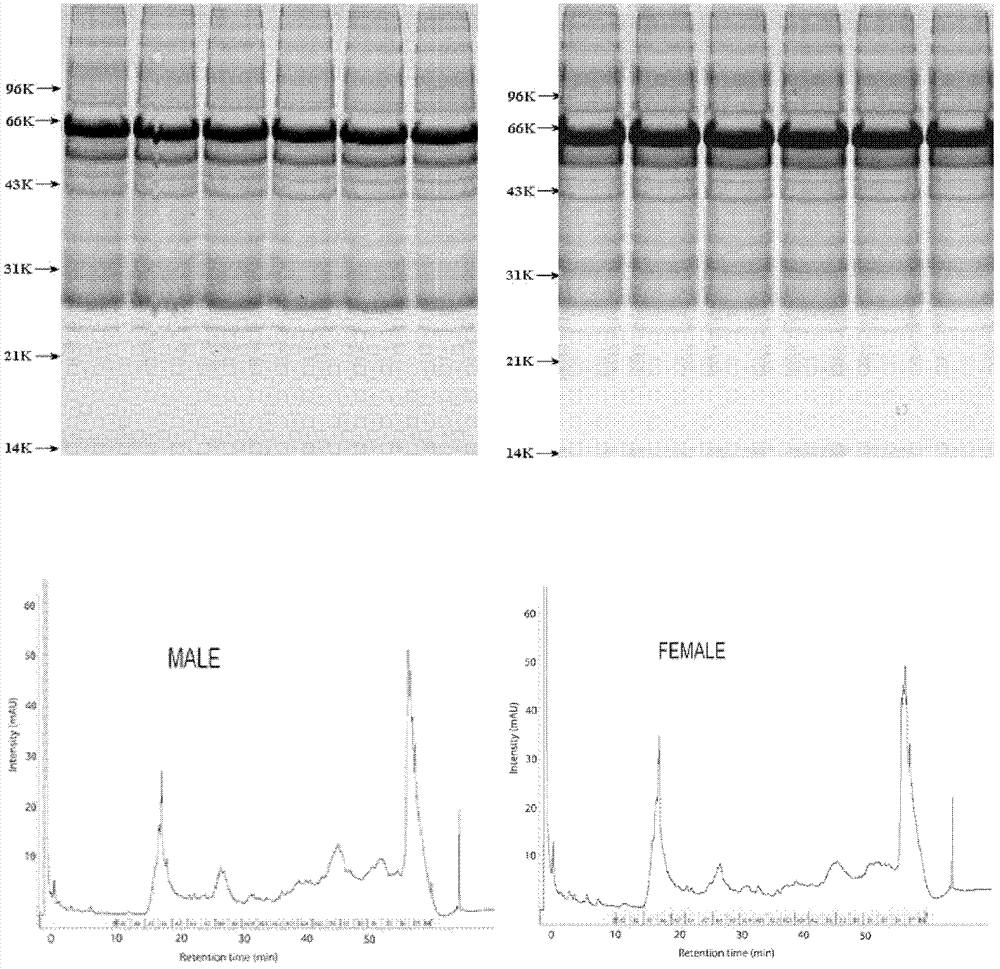 Testing kit and testing method for early screening or assisting diagnosis of urinary system diseases as well as applications of testing kit and testing method