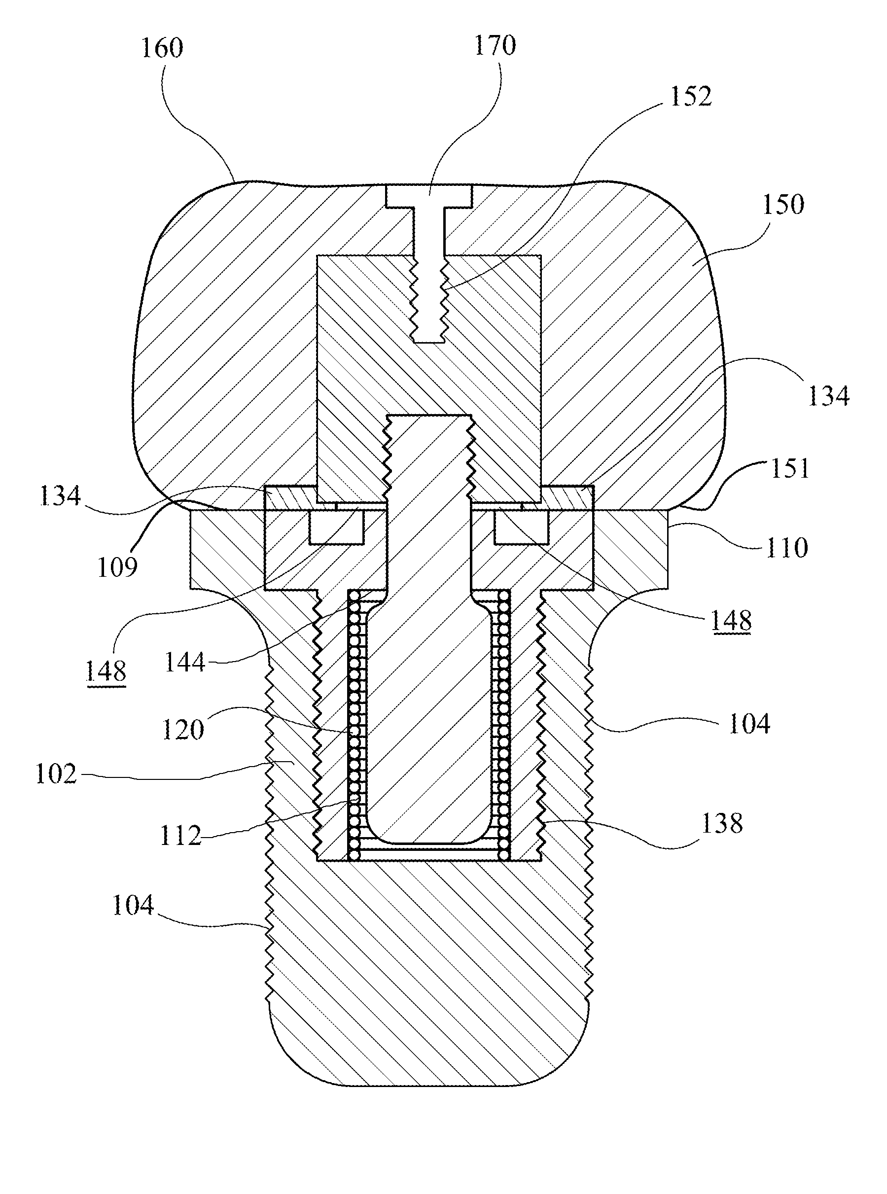 Dental implant assembly for uniform distribution of occlusal forces