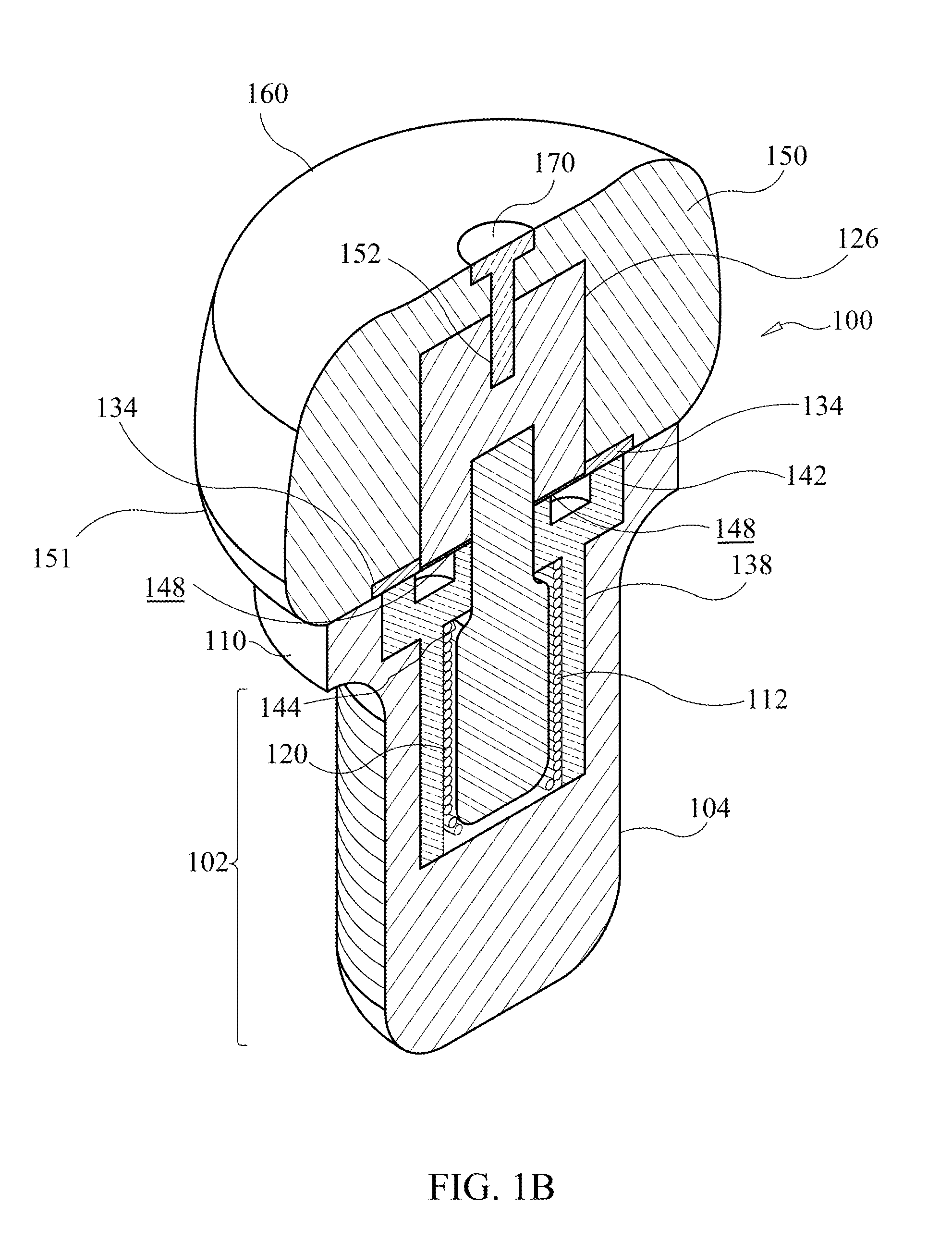 Dental implant assembly for uniform distribution of occlusal forces