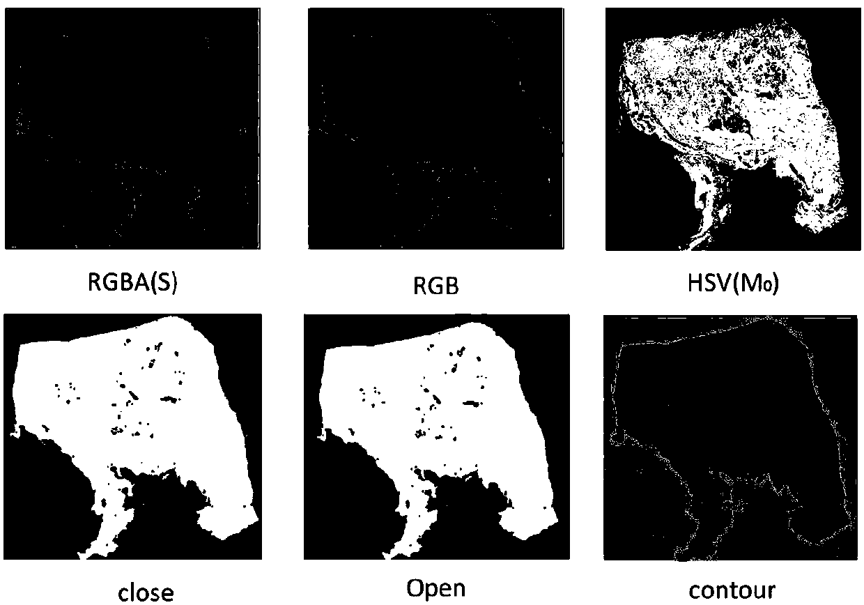 Medical image preprocessing method