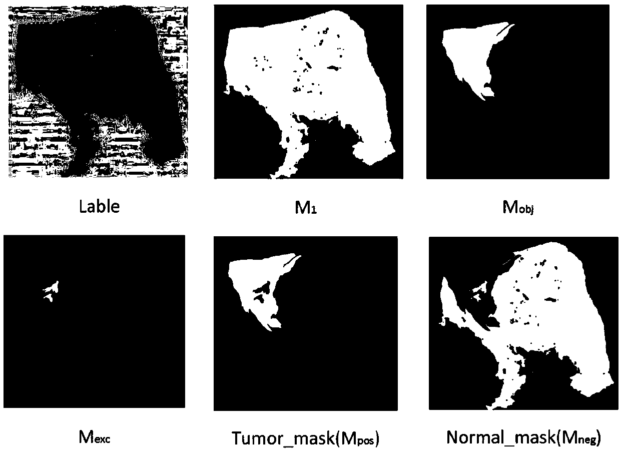 Medical image preprocessing method