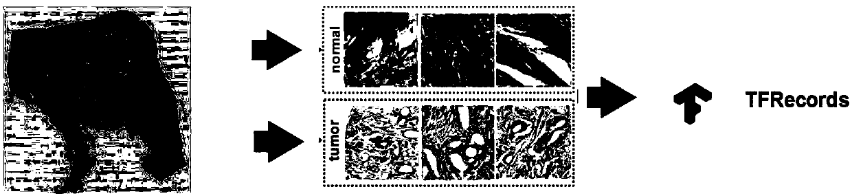 Medical image preprocessing method