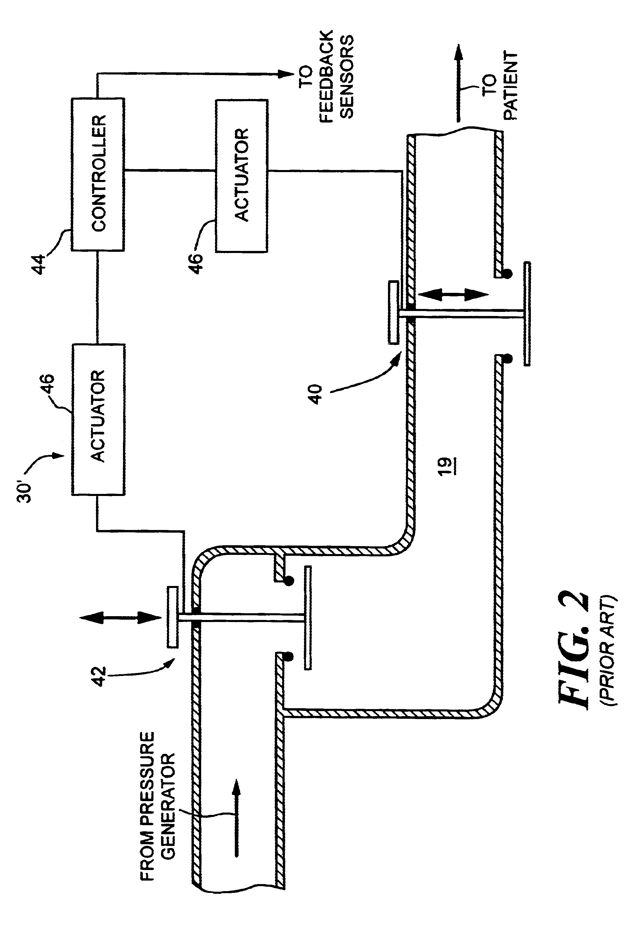 Pressure support system and method and a pressure control valve for use in such system and method