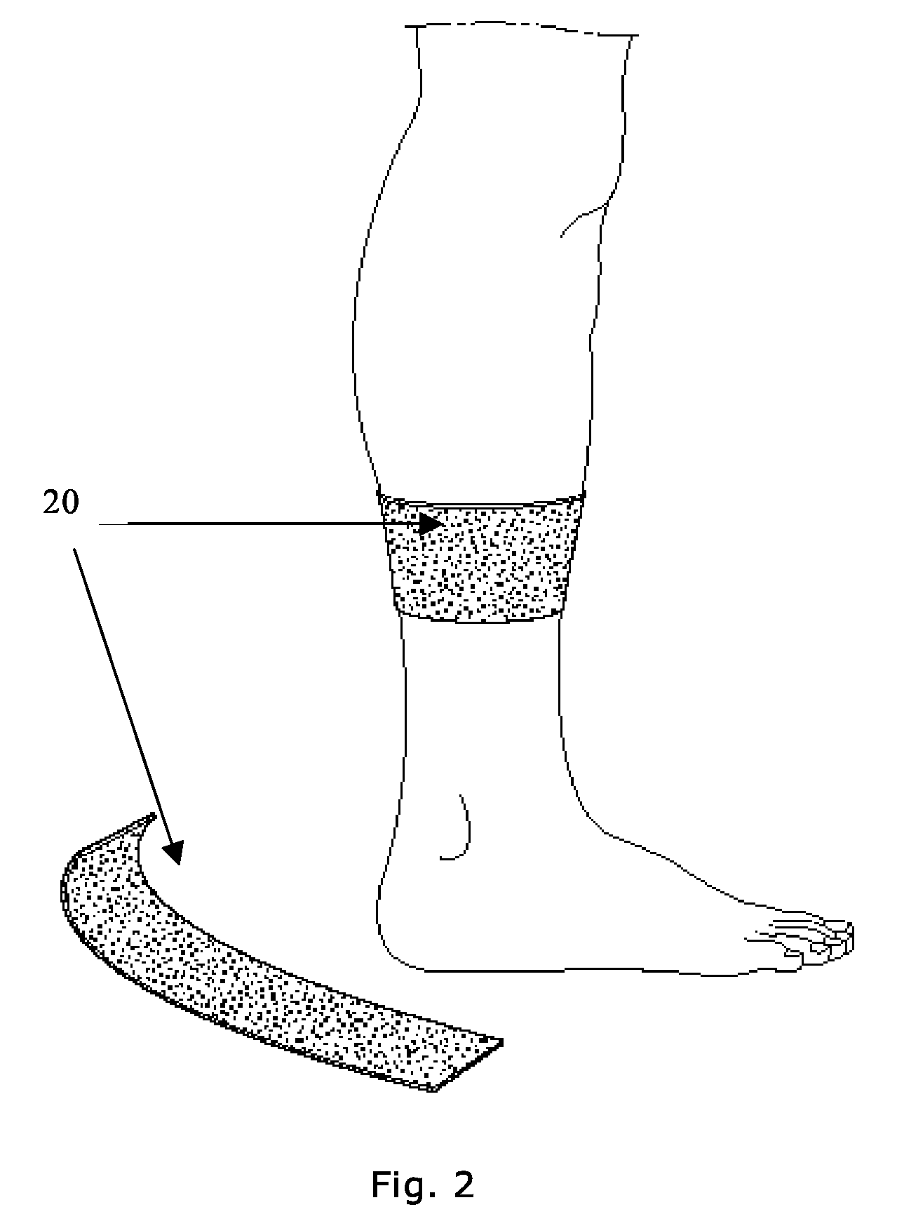 Treatment And Pre-Treatment Device, And Manufacturing Method Therefor, Involving Nitric Oxide