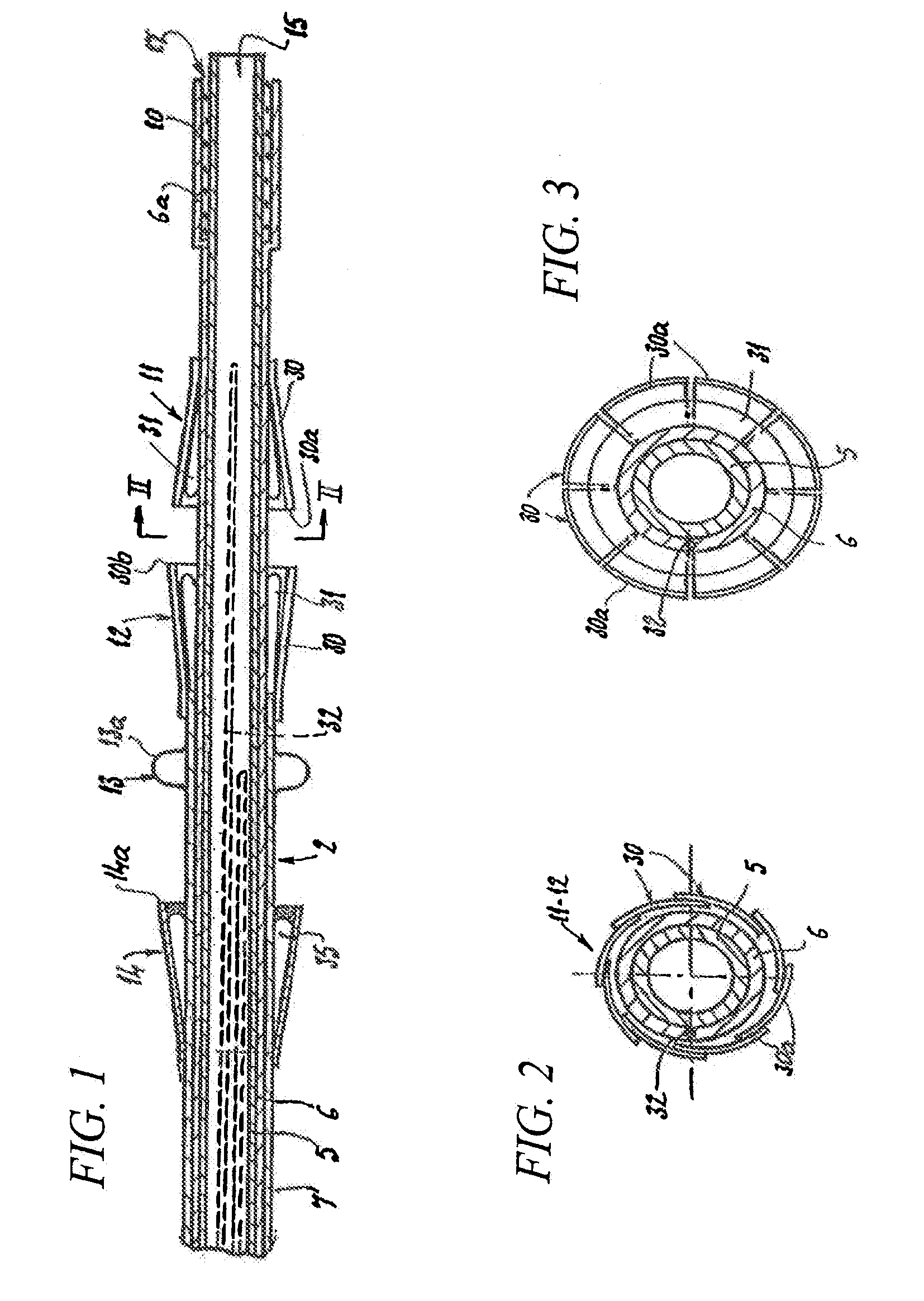 Prosthetic Valve For Transluminal Delivery