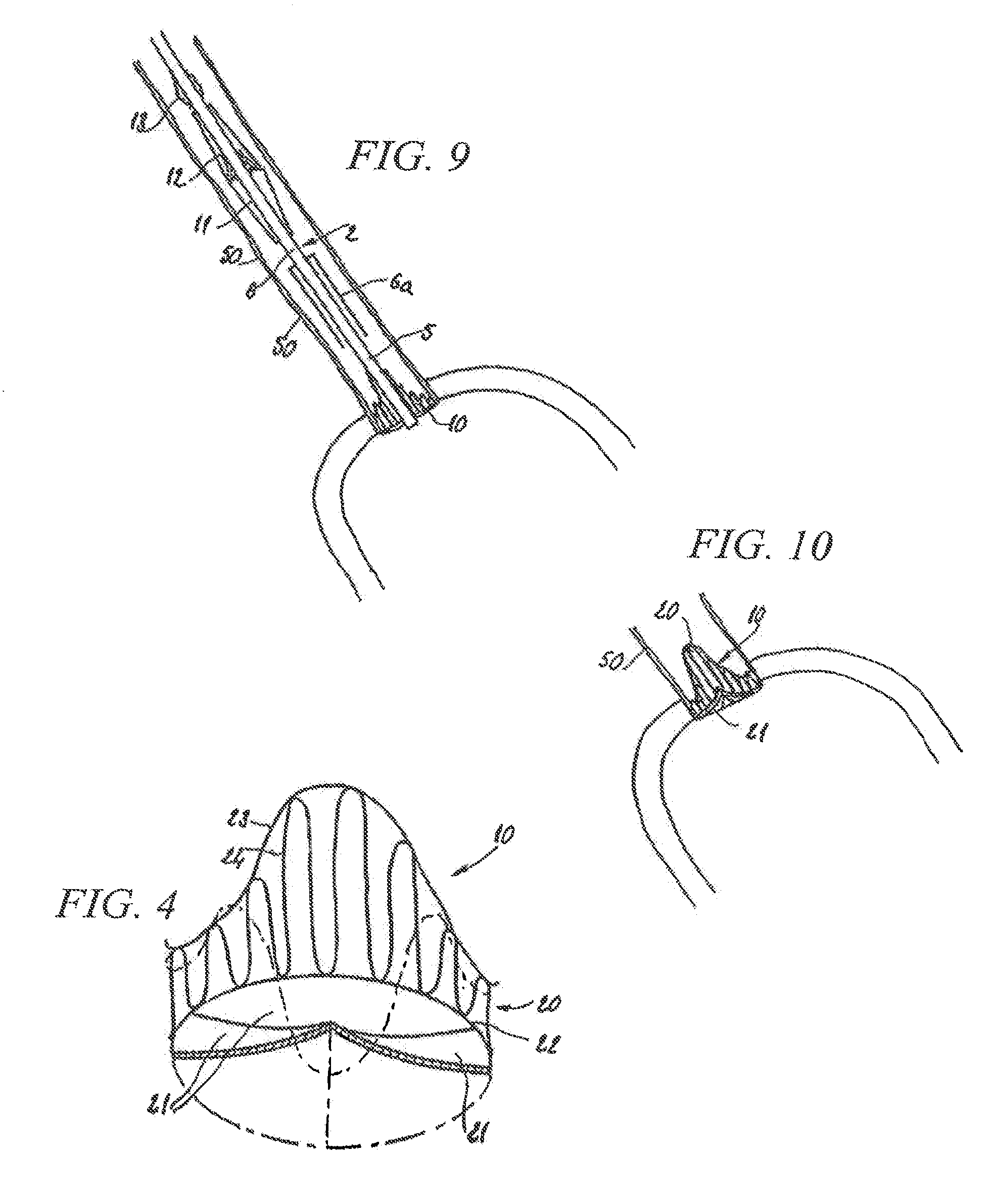 Prosthetic Valve For Transluminal Delivery