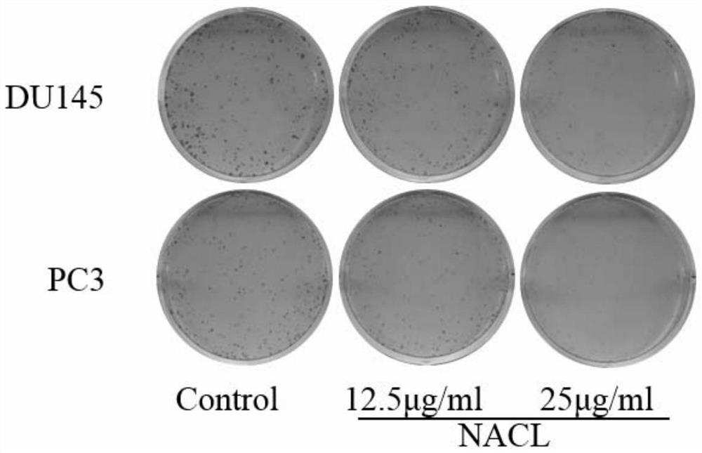 Tung flower leaves n-butanol extract and its preparation and application in treating prostate cancer