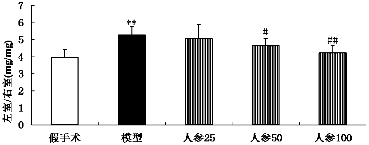 A kind of anti-myocardial hypertrophy pharmaceutical composition and preparation method thereof