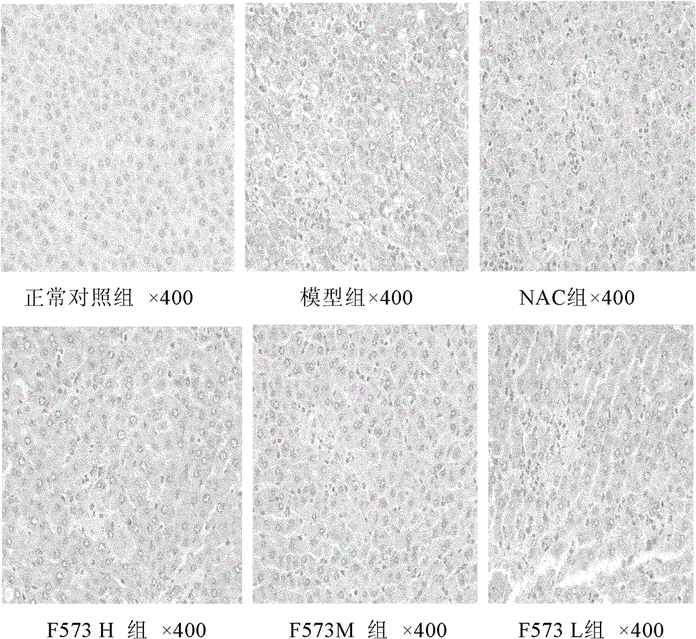 A dipeptide derivative for improving liver function and its application