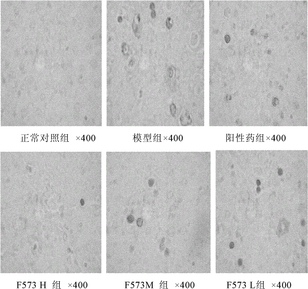 A dipeptide derivative for improving liver function and its application