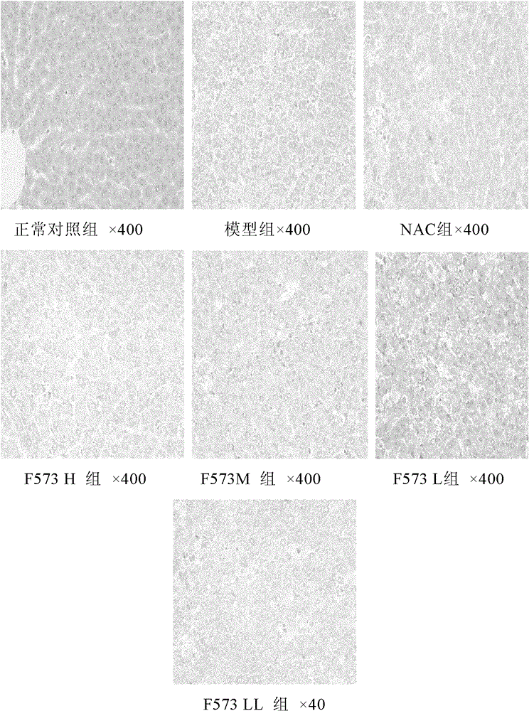 A dipeptide derivative for improving liver function and its application