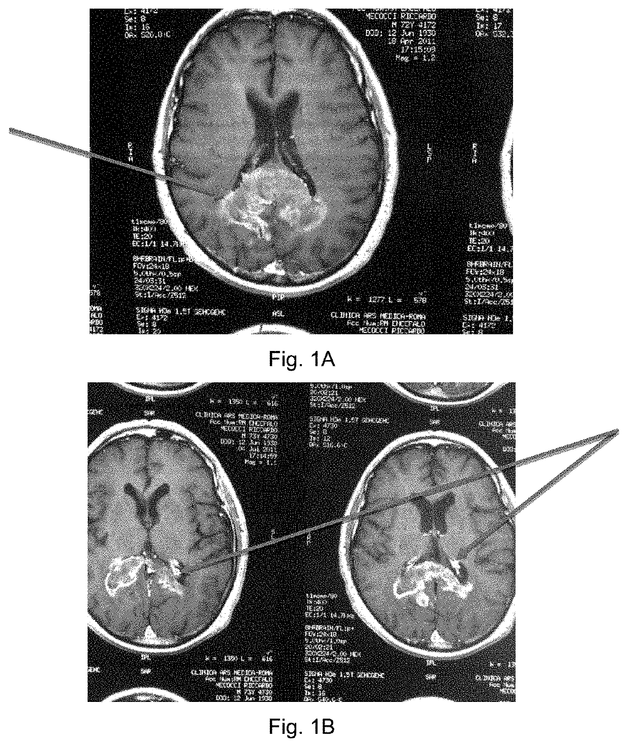 Compositions comprising resveratrolosides and curcumins