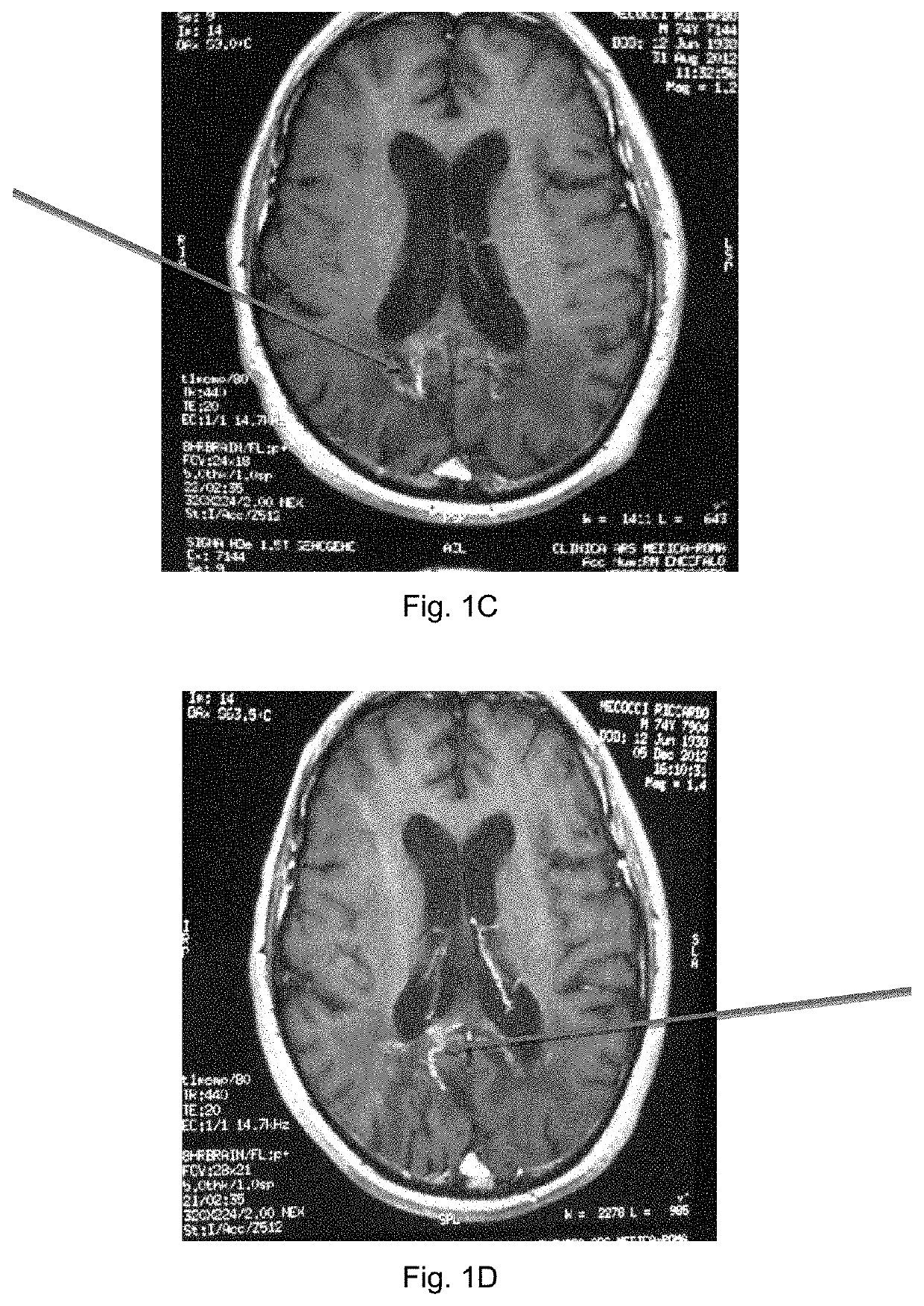 Compositions comprising resveratrolosides and curcumins