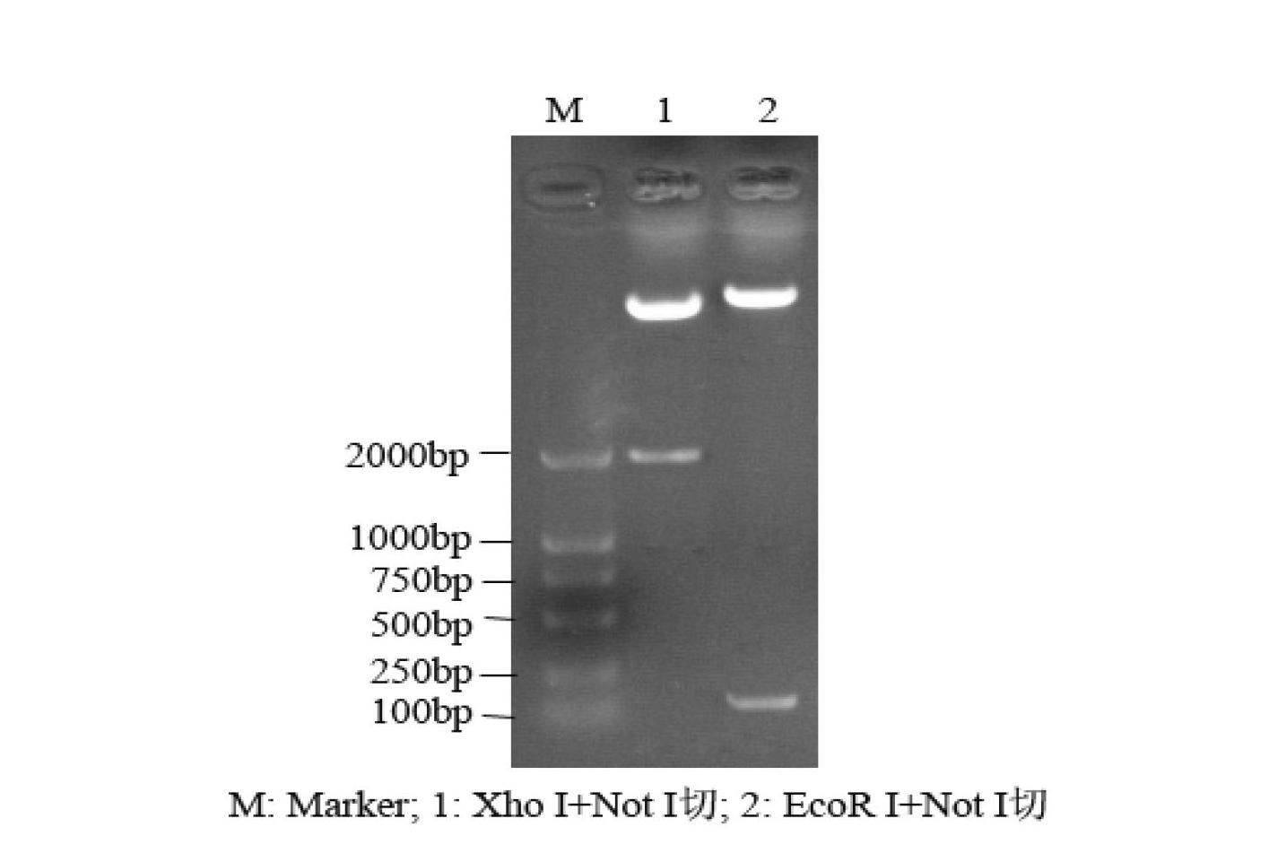 Preparation method of gene-recombination human thymosin beta 4