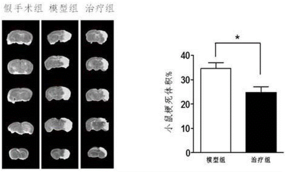 Application of chrysin in the treatment of ischemic stroke