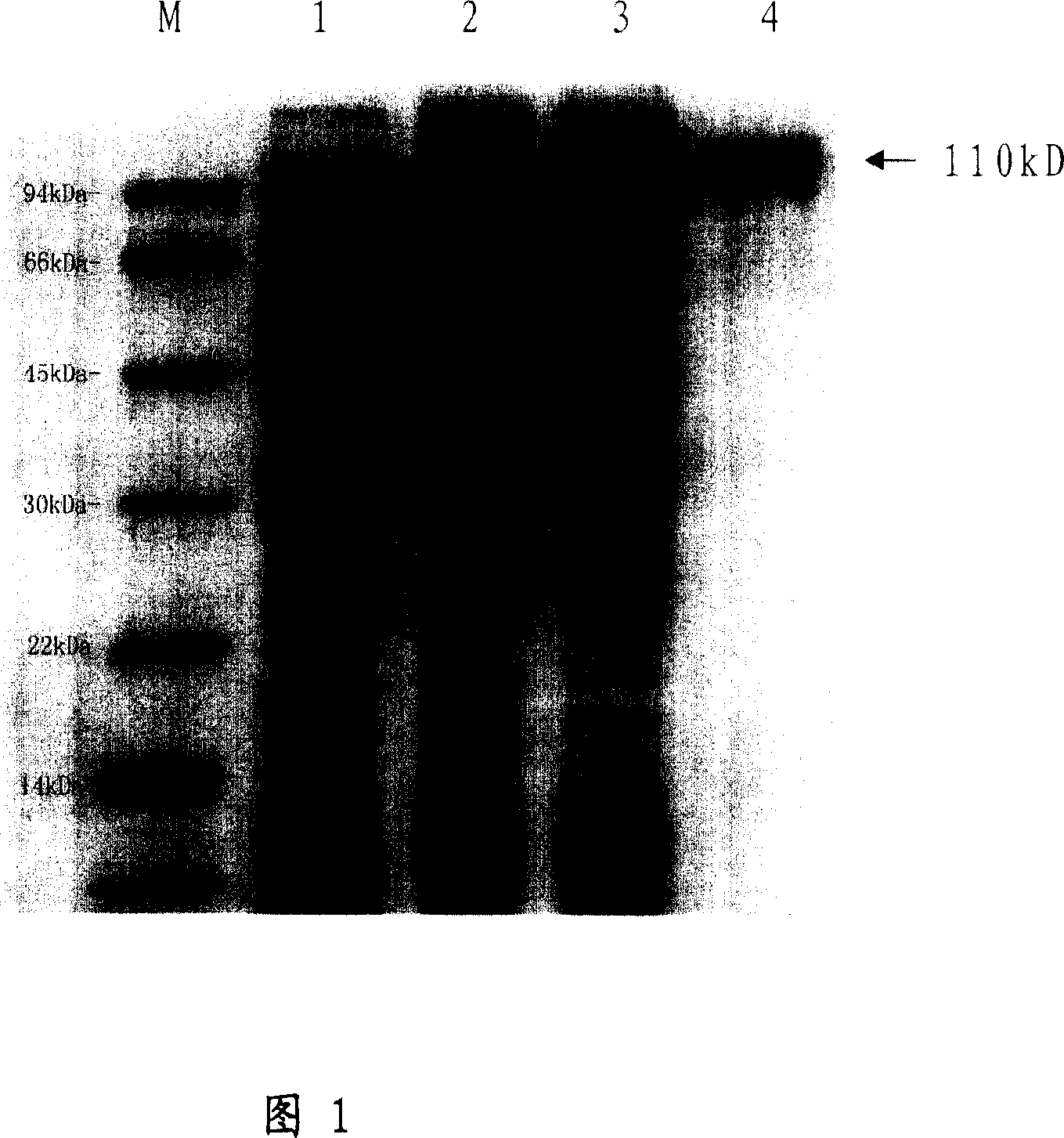 Trichina paramyosin gene and application thereof