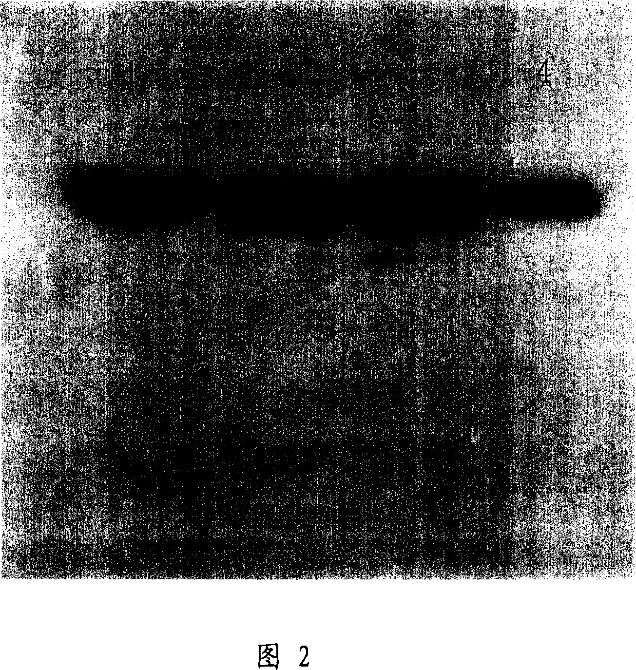 Trichina paramyosin gene and application thereof