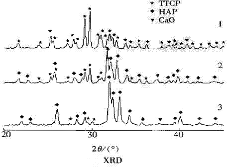 Preparation process of rear earth yttrium ion doped tetracalcium phosphate