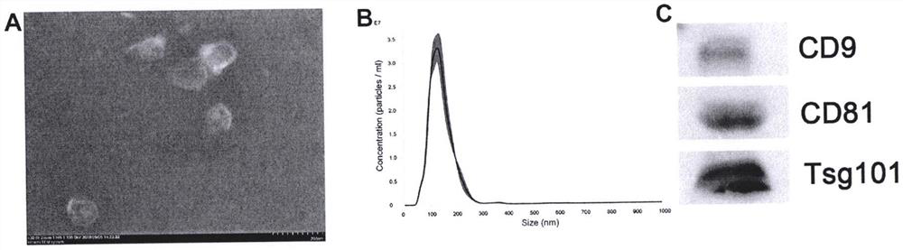 Injectable bone-repairing hydrogel containing exosomes of human umbilical cord mesenchymal stem cells and preparation method of injectable bone-repairing hydrogel