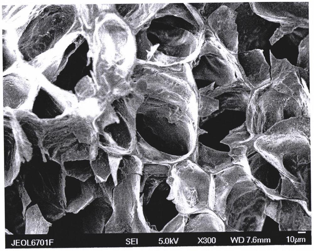 Injectable bone-repairing hydrogel containing exosomes of human umbilical cord mesenchymal stem cells and preparation method of injectable bone-repairing hydrogel