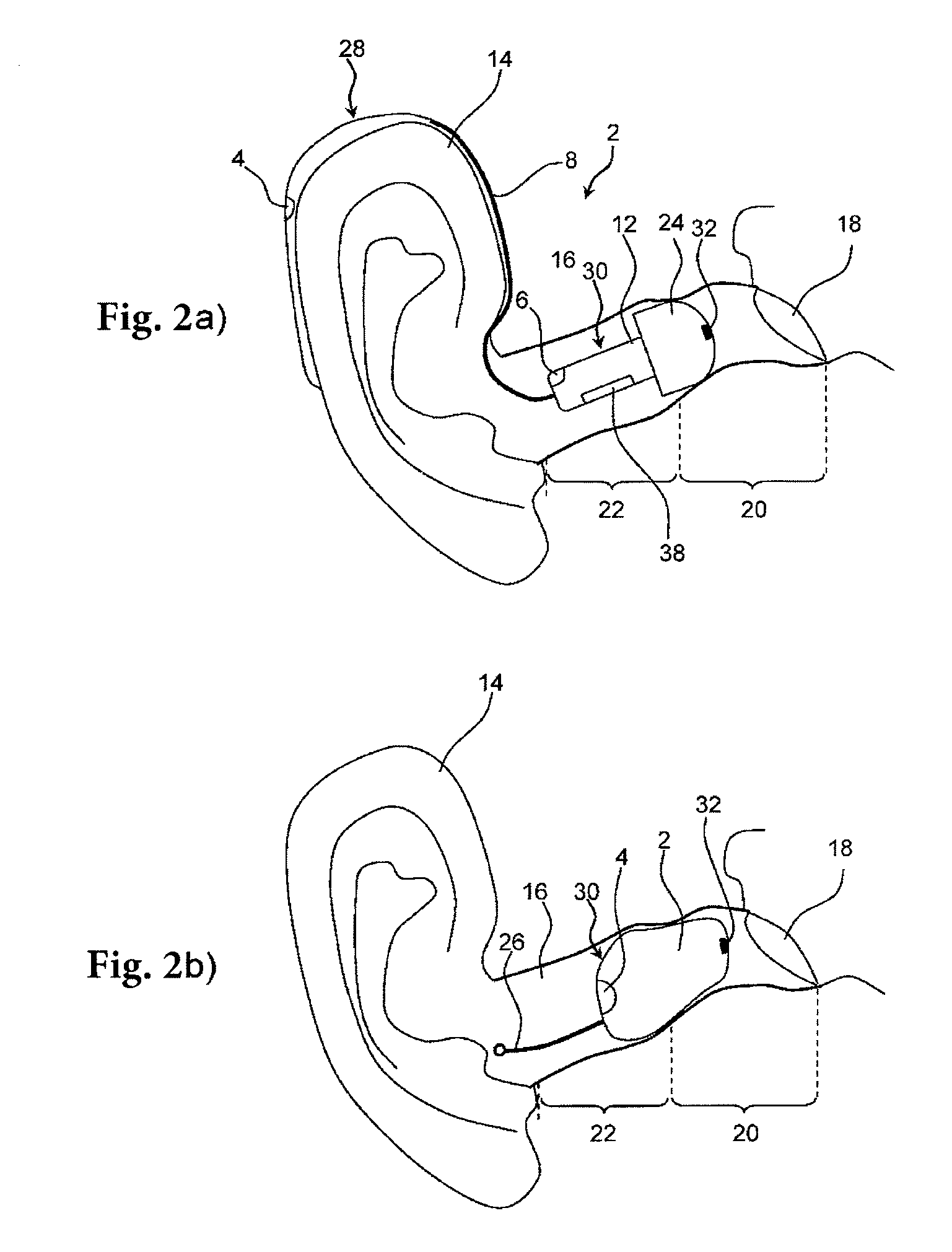 Hearing aid device and method for feedback reduction