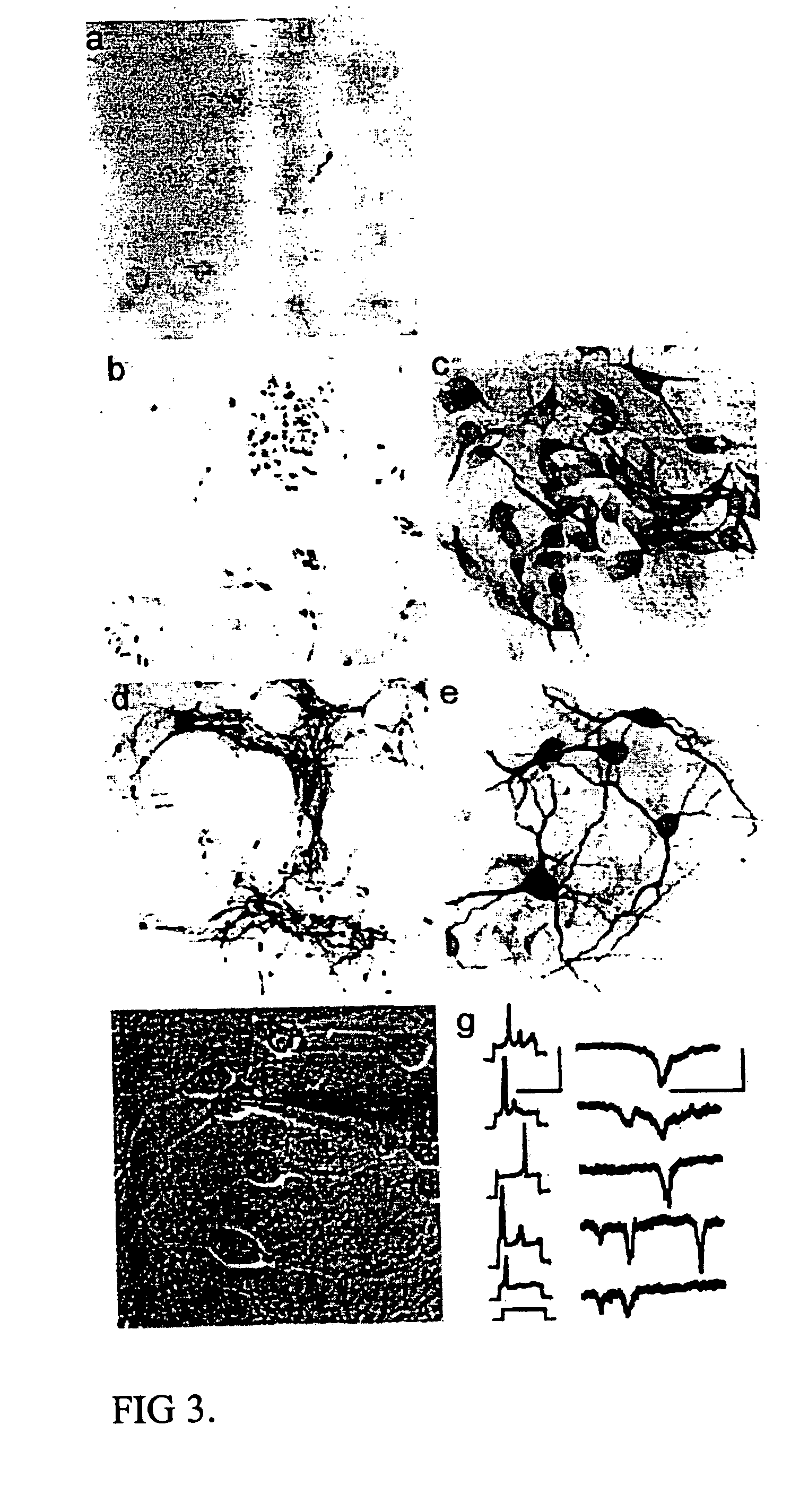 Cultures of GFAP nestin cells that differentiate to neurons