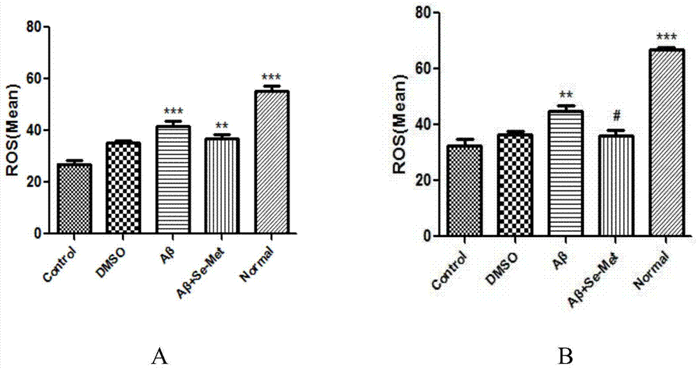 Application of selenomethionine in preparation of medicine for treating Alzheimer's disease