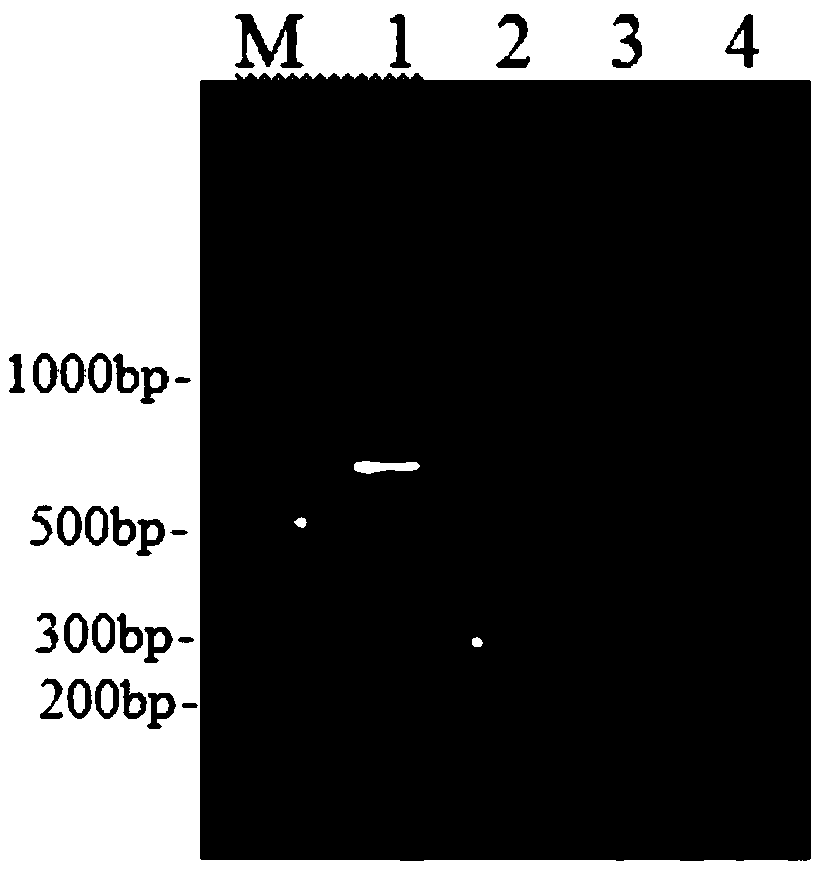 Kit for RT-PCR typing detection of chicken infectious bronchitis virus