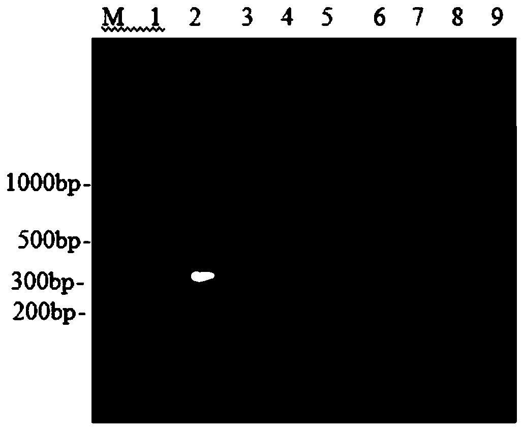 Kit for RT-PCR typing detection of chicken infectious bronchitis virus