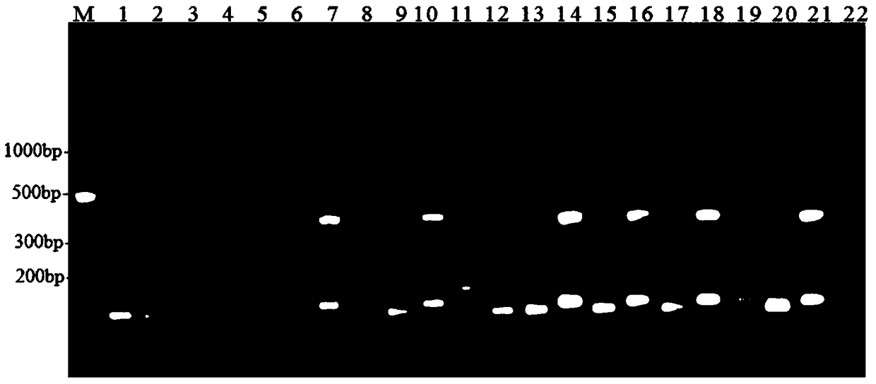 Kit for RT-PCR typing detection of chicken infectious bronchitis virus