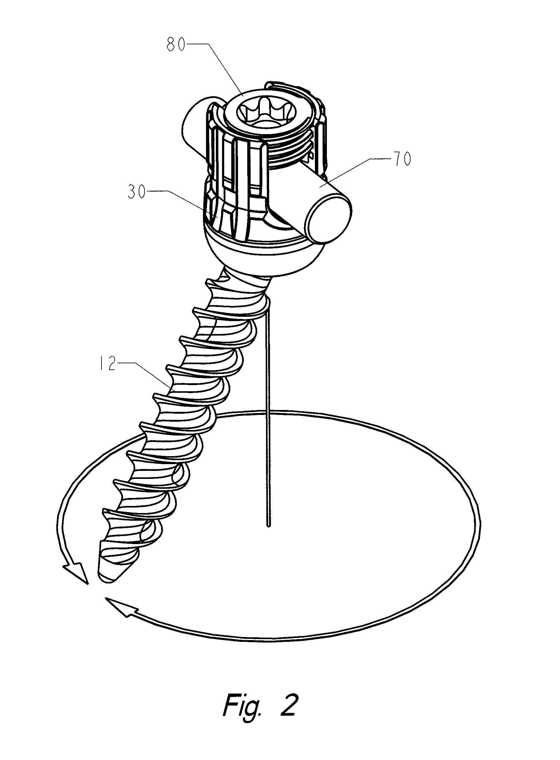 Locking polyaxial ball and socket fastener