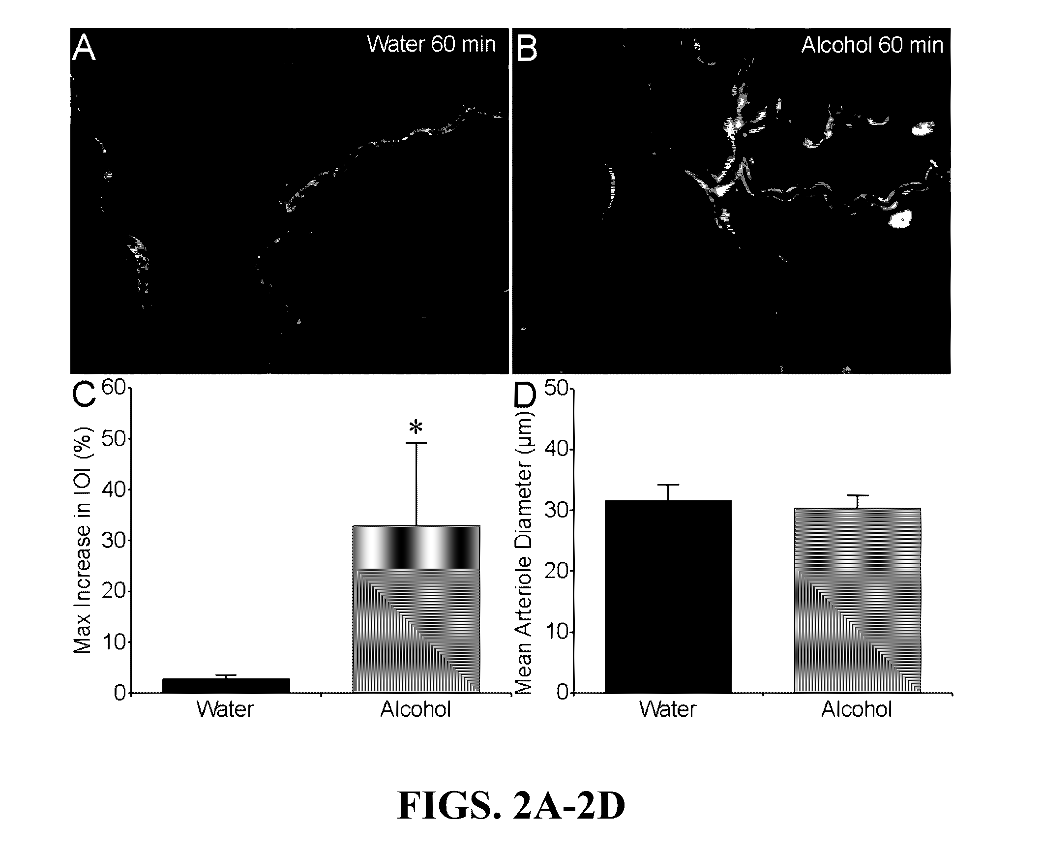 Stabilization of alcohol intoxication-induced cardiovascular instability