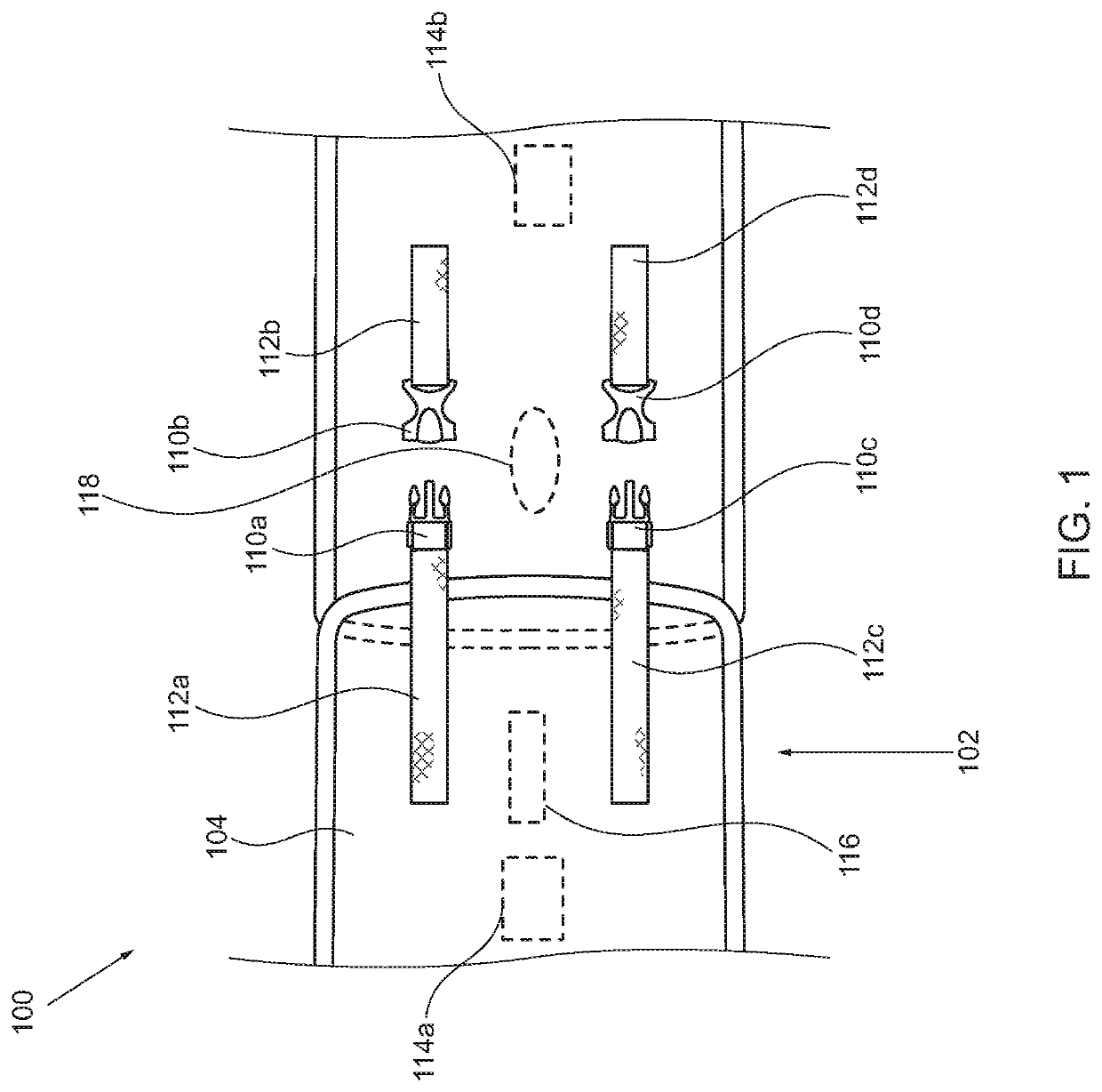 Massaging Apparatus for Wrapping Around Abdomen