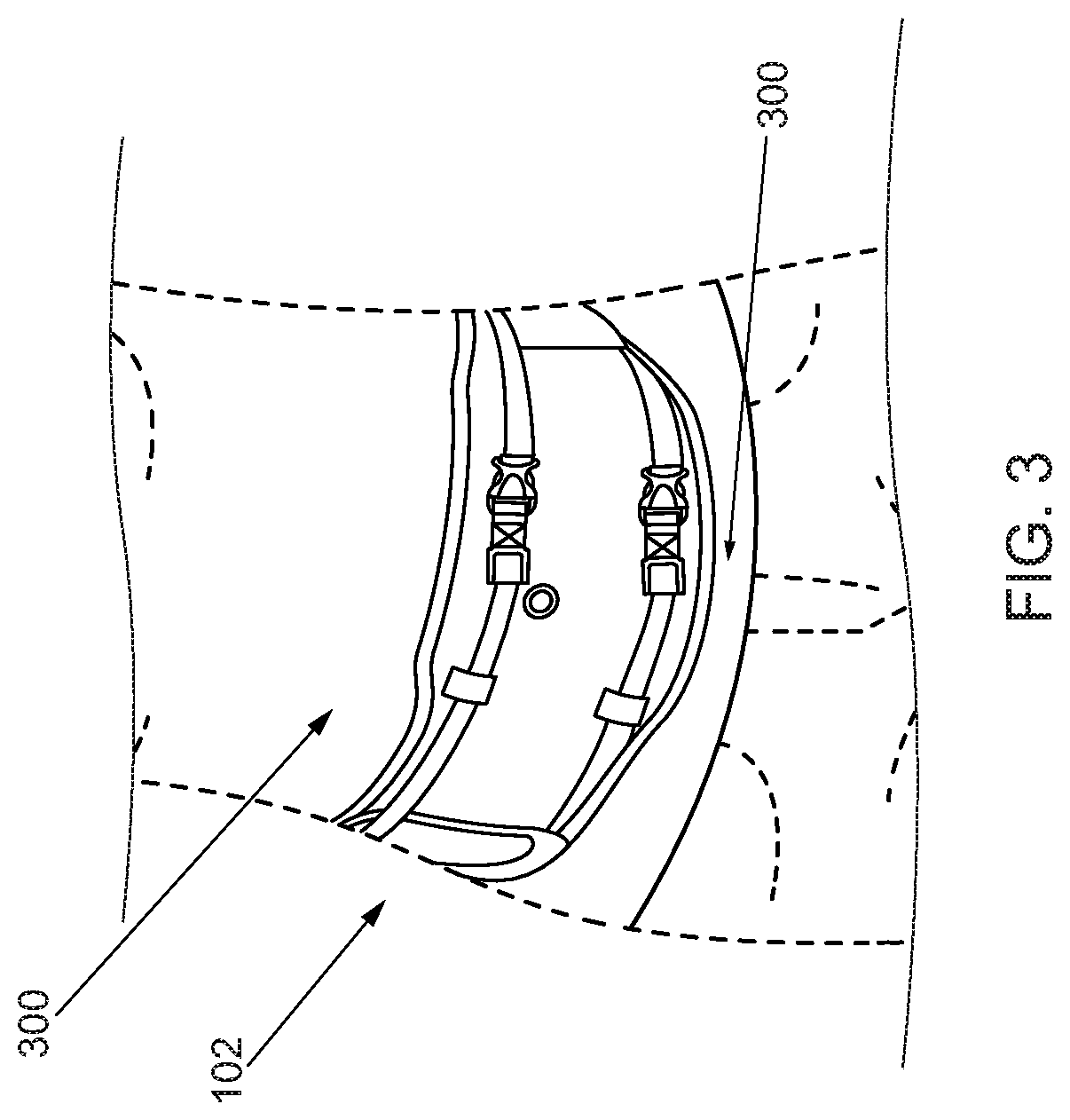 Massaging Apparatus for Wrapping Around Abdomen