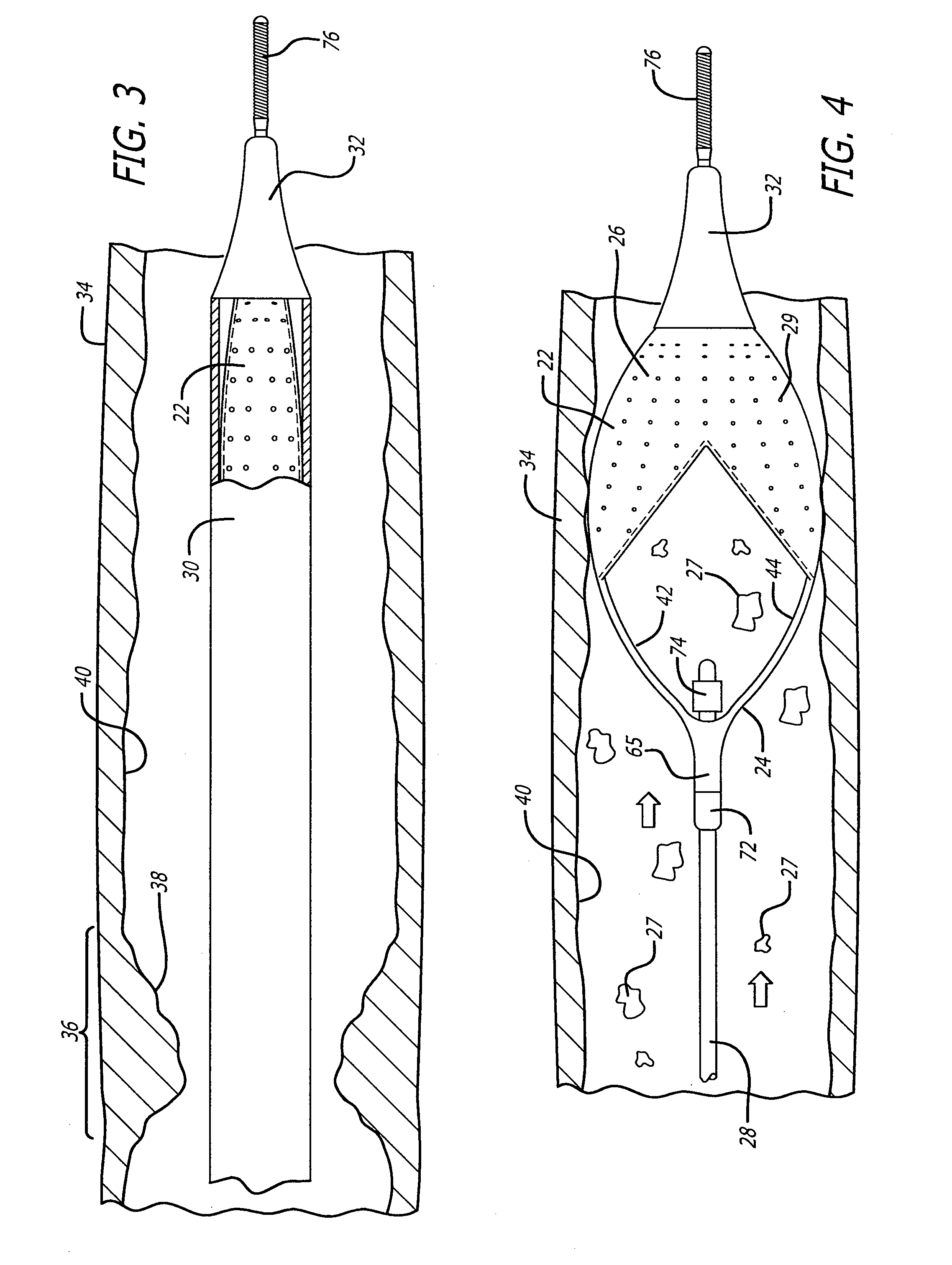 Flexible and comformable embolic filtering devices