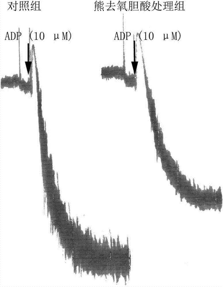 Ursodesoxycholic acid and use thereof