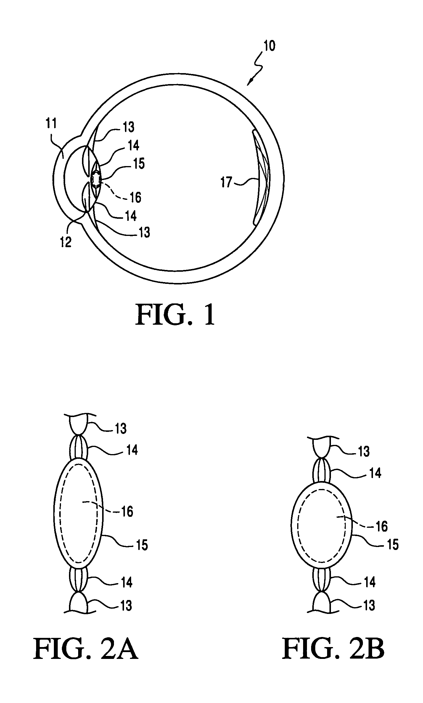 Accommodating intraocular lens system and method