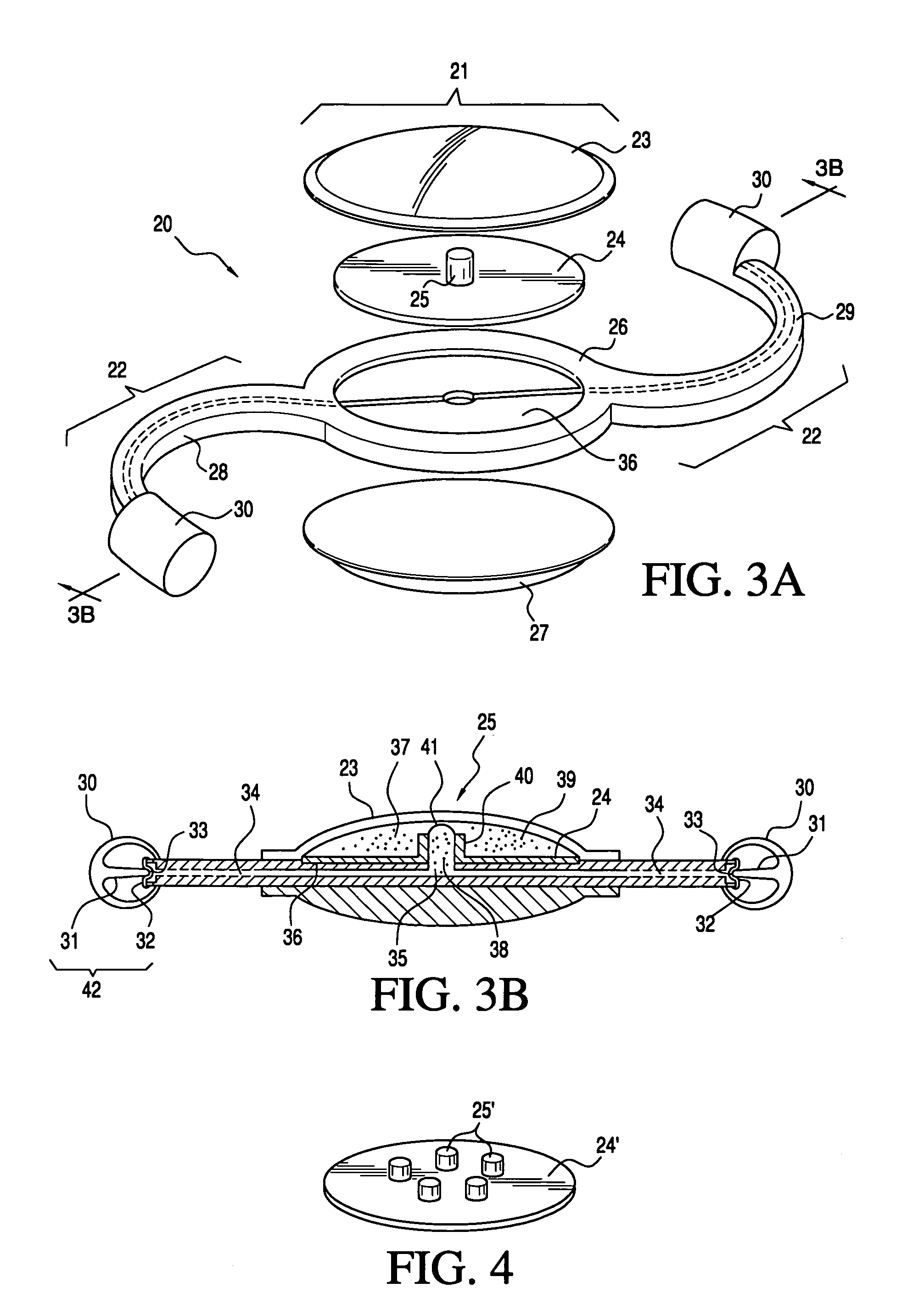 Accommodating intraocular lens system and method