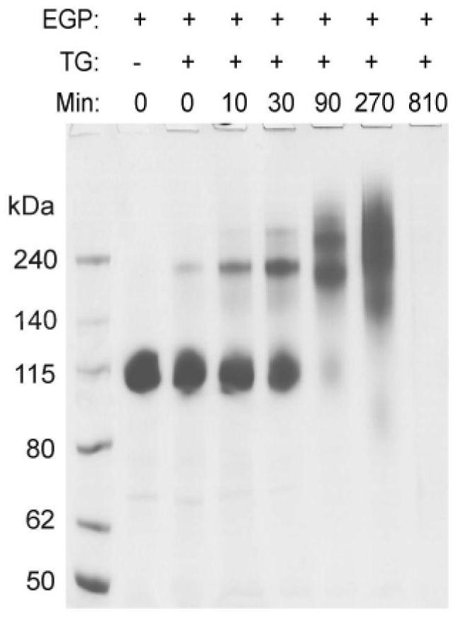 Truncated protein of bombyx mori ovomucoid and application thereof