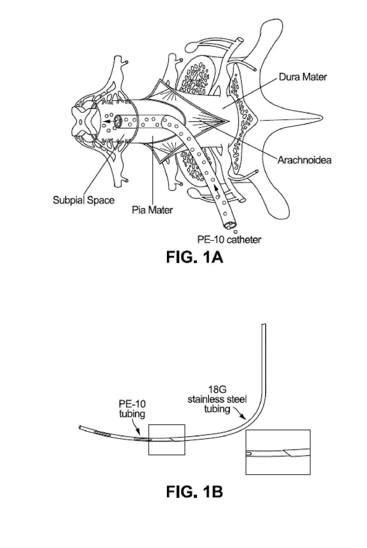 Spinal subpial gene delivery system