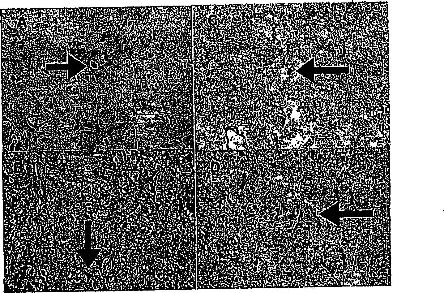 Compositions enriched in neoplastic stem cells and methods comprising same